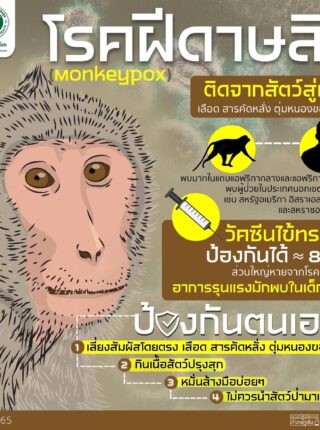 ฝีดาษลิง อาการเป็นอย่างไร ตามมาดู